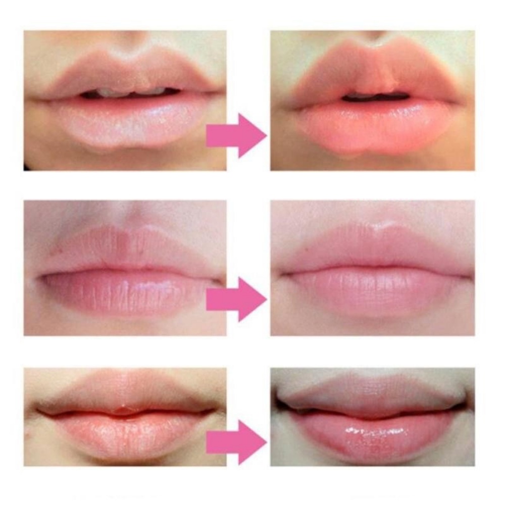 Mặt Nạ Môi Bioaqua Chery Dưỡng Ẩm Chống Khô Nẻ Hộp 20 Miếng 60g