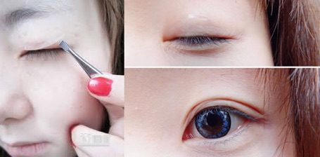 Kích mí lưới thần thánh Keli