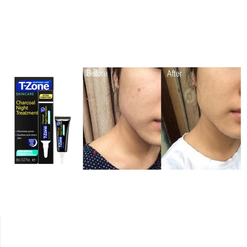 Gel Ngừa Thâm Mụn Ban Đêm Tinh Chất Than Hoạt Tính T-Zone 8ml | BigBuy360 - bigbuy360.vn