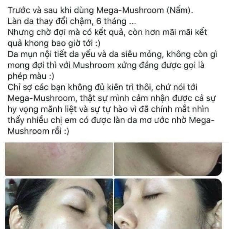 Toner nấm phục hồi Origins Mega Mushroom 200ml | BigBuy360 - bigbuy360.vn