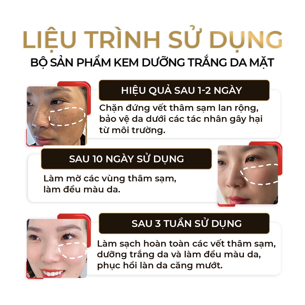 Bộ Sản Phẩm Kem Dưỡng Trắng Da Mặt  Melasma White Perfect 30g, Serum Cho Da Nhạy Cảm Oriskin Brightening Serum 20ml