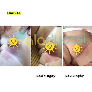 Xịt kháng khuẩn Maxibac ( bộ đôi xịt + gel maxibac)
