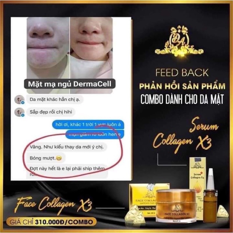 Combo Kem face X3 - Serum nám X3 collagen Đông anh Chính hãng