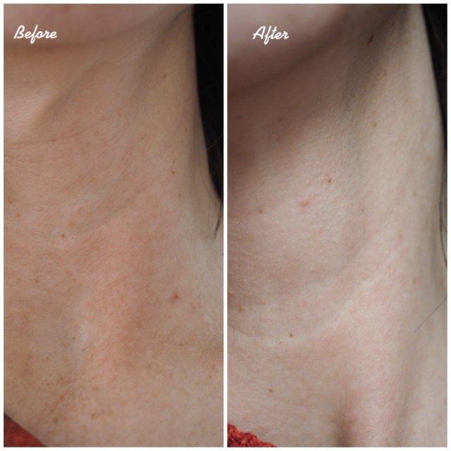 Bill Canada Niod serum phục hồi da Modulating Glucosides