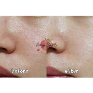 Kem dưỡng SKIN1004 MADAGASCAR CENTELLA