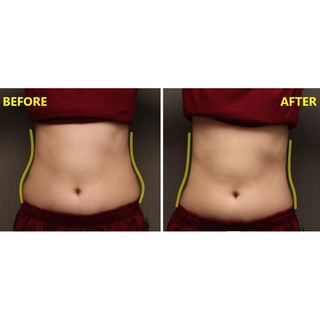 MÁY MASSAGE HUỸ MỠ SLINE PRO