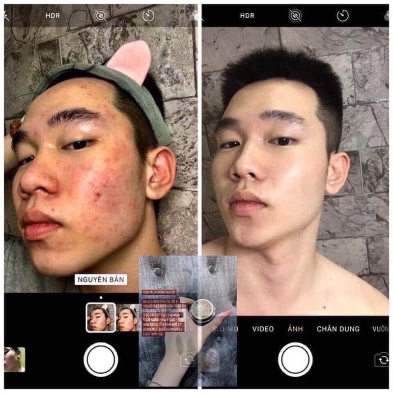 Cao mụn sâm đỏ hủ to 15gram | BigBuy360 - bigbuy360.vn