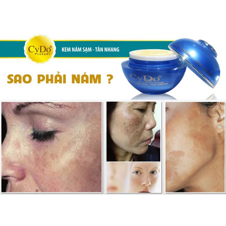 Kem Nám ,sạm,tàn nhang Luxury CyDo 16g-Chính Hãng