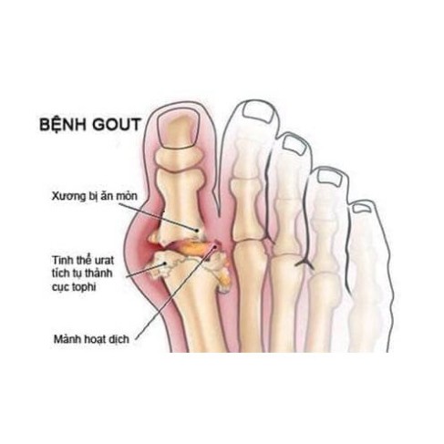 [Nhật nội địa] Viên uống hỗ trợ bệnh GOUT - Anserine Minami