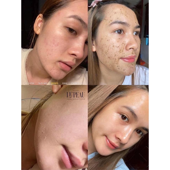 Peel Da Retinol Vi Tảo LE PEAU, Tinh Chất Tái Tạo Da Sinh Học Căng Bóng, Tặng Kèm Serum B5 Phục Hồi - 10ml