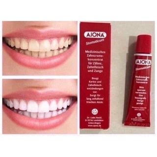 [FreeShip] Kem đánh răng Ajona 25ml, ngừa hôi miệng viêm nướu [ Hàng Đức ]