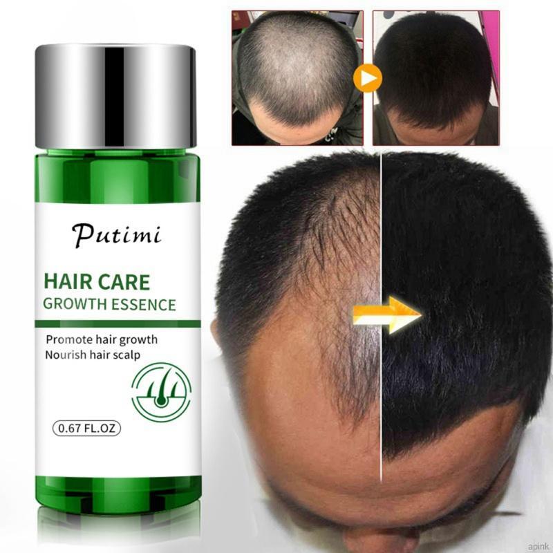 Tinh Chất Kích Thích Mọc Tóc Nuôi Dưỡng Da Đầu Chống Rụng Tóc