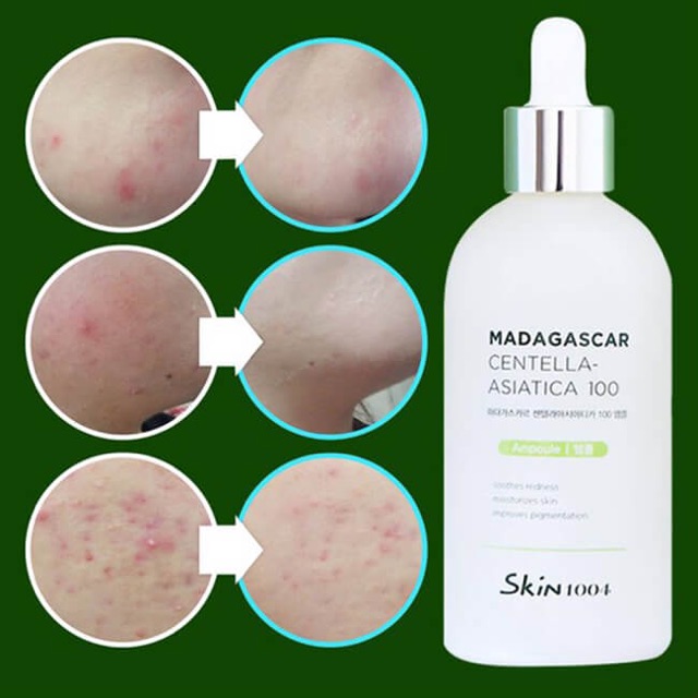 Tinh chất rau má skin1004 madagascar centella asiatica 100 ampoule | BigBuy360 - bigbuy360.vn