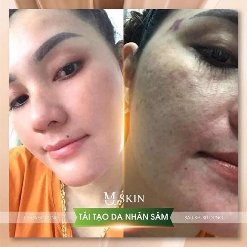 Kem Tái Tạo Da BB Cream MQ SKin