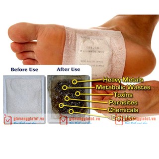 10 Miếng dán khử độc bàn chân