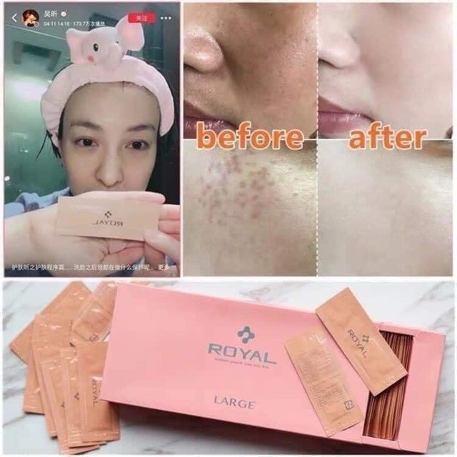  [Sỉ] SERUM NHAU THAI ROYAL ,Tinh Chất Nhau Thai Cừu Trắng Da [ LYSHOP ]. | BigBuy360 - bigbuy360.vn