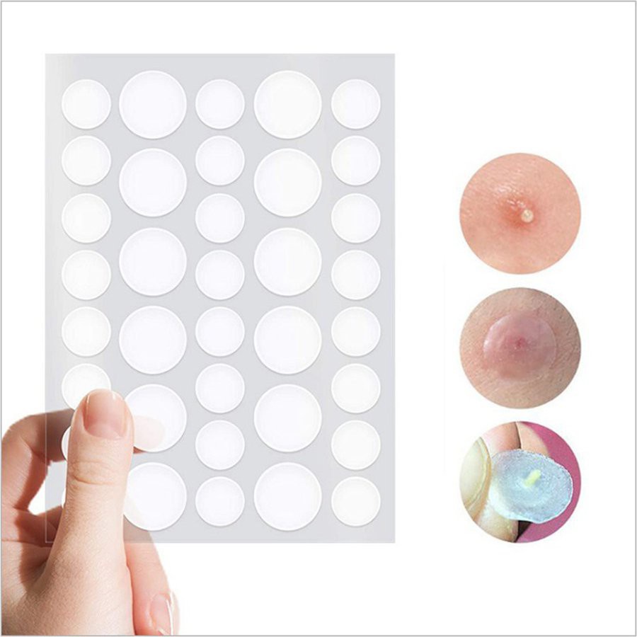 ☎Acne Patch Facial Beauty Acne Pimple Healing Patch Skin Treatment Stickers