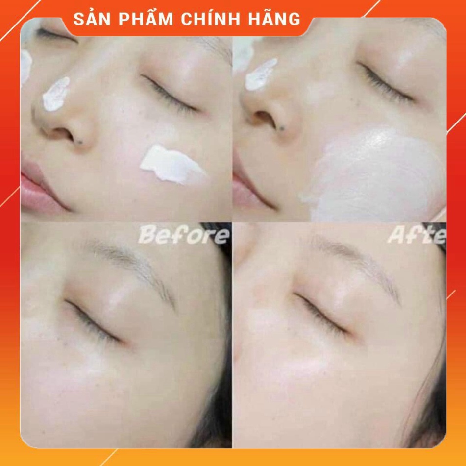 Kem Chống Nắng SJM Medical Anti UV SPF50/PA++++