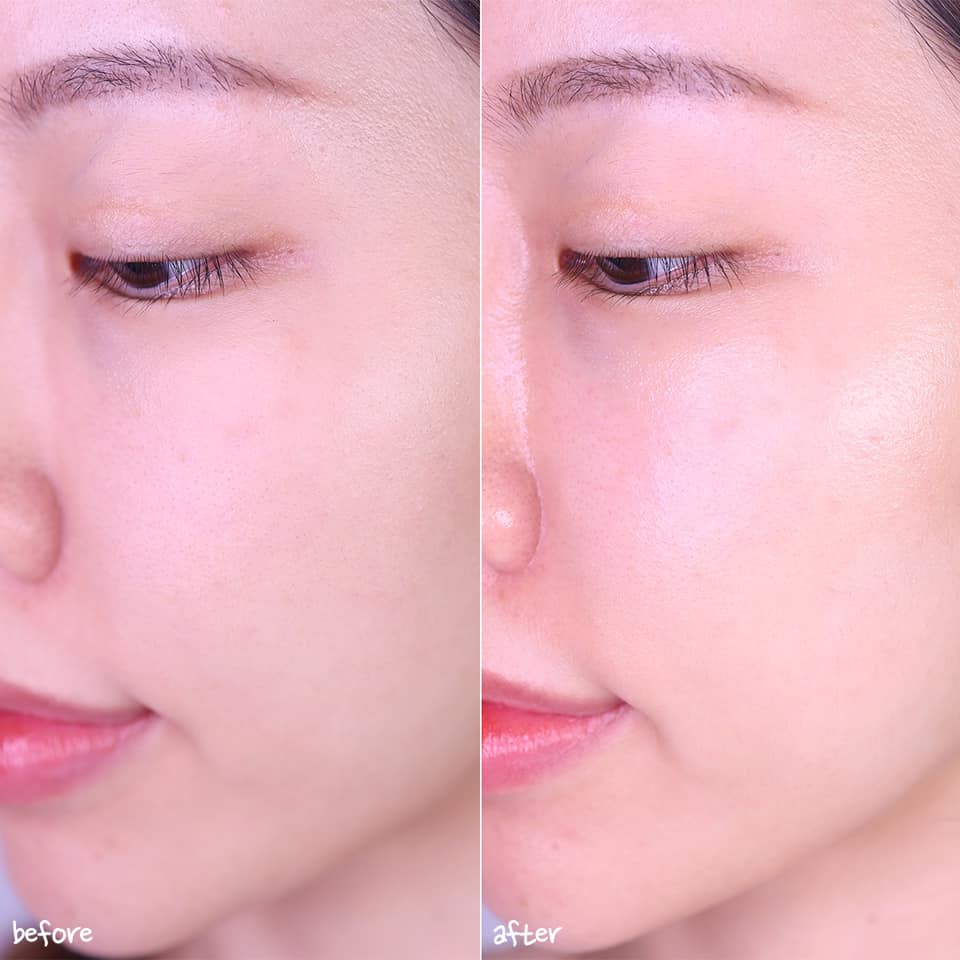 Kem Retinol chống lão hóa, thâm nám, tàn nhan, mụn và lỗ chân lông to ABRASKIN RETINOL CREAM 0.08% 30g