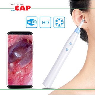 Camera Nội Soi Tai Mũi Họng Không Dây WiFi Kết Nối Điện Thoại F180