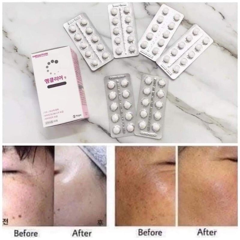 Viên Uống Mờ Hủy Nám M Clear 60 viên