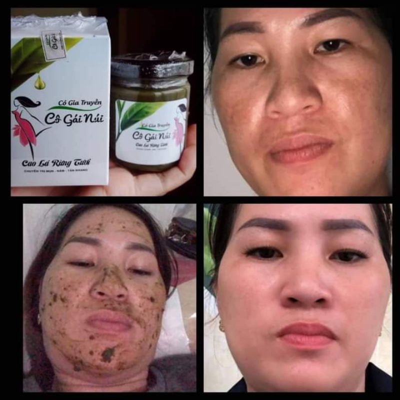 Mặt nạ cô gái núi sạch nám tận gốc