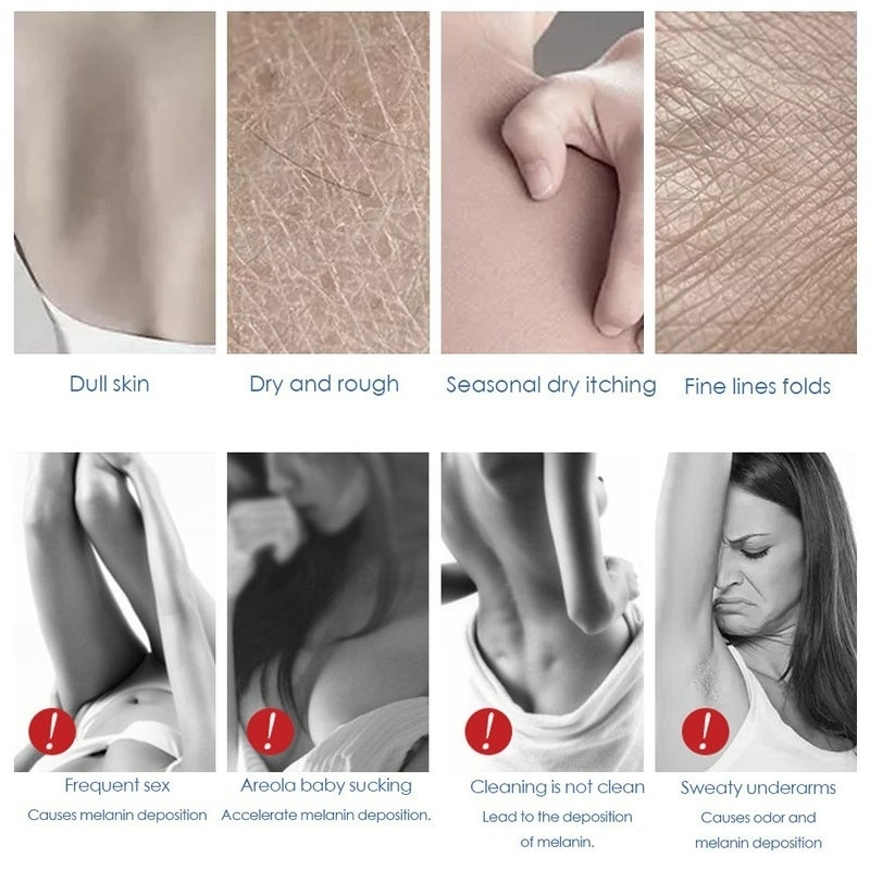 Kem Dưỡng Ẩm Làm Trắng Và Loại Bỏ Melanin Cải Thiện Làn Da Dưới Cánh Tay