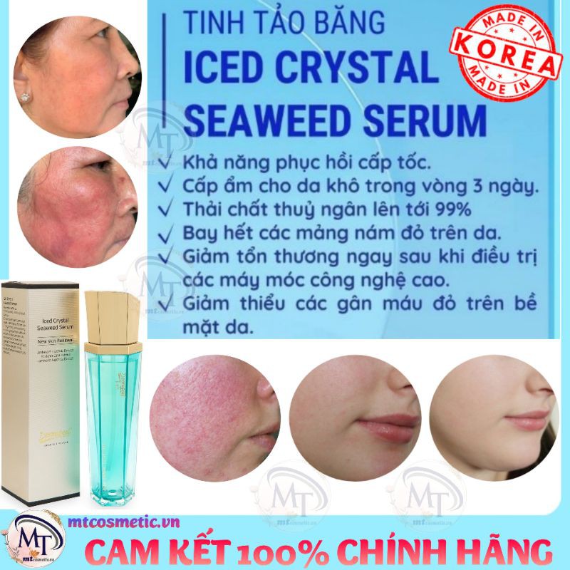 Dermapeel TINH TẢO BĂNG - ICED CRYSTAL SEAWEED SERUM - GIẢM TÌNH TRẠNG DA SƯNG ĐỎ NHANH CHÓNG - PHỤC HỒI DA HƯ TỔN 100ml