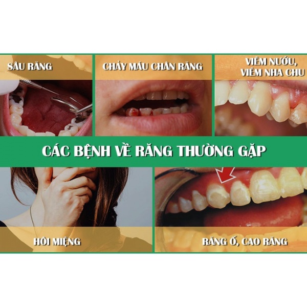 nước súc miệng thanh mộc hương chính hãng