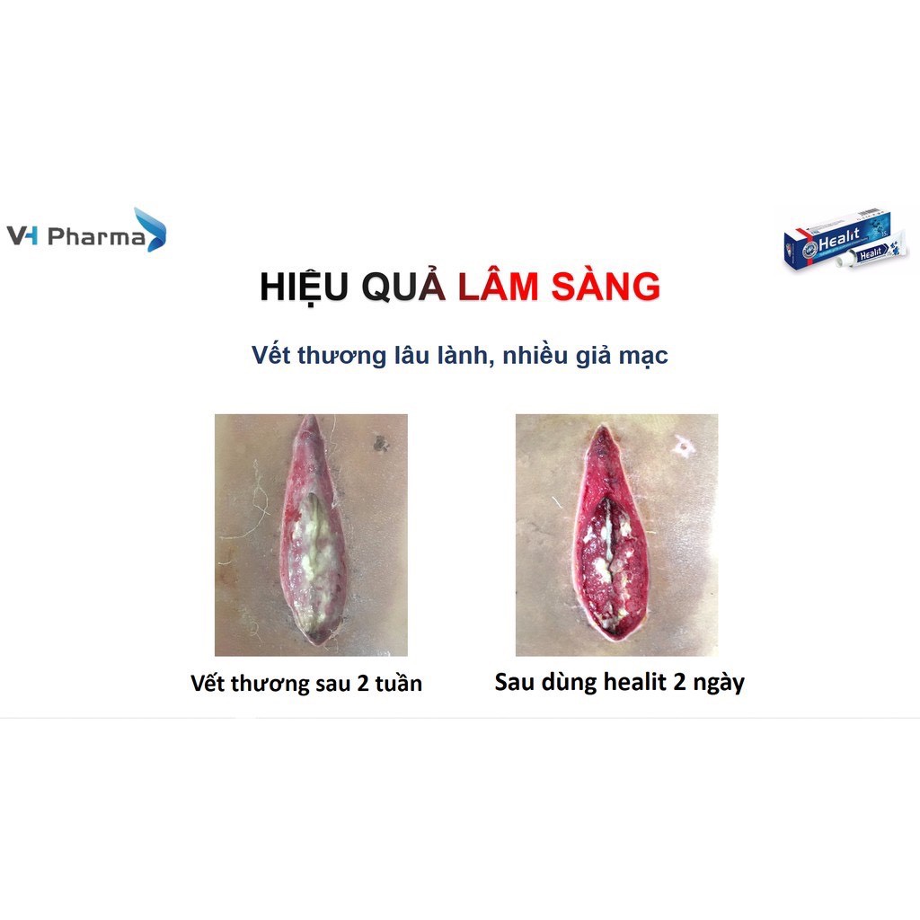 Healit gel - Gel bôi vết thương hở cấp và mạn tính