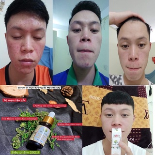Serum Mộc Beauty