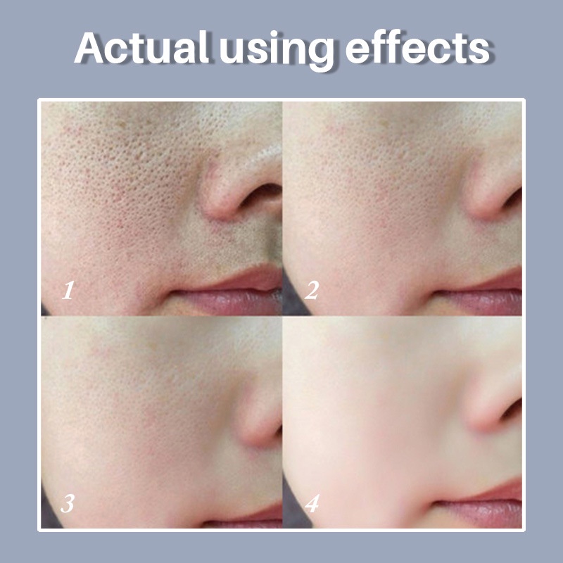 Serum Hyaluronic Acid Dưỡng Ẩm Se Khít Lỗ Chân Lông Và Phục Hồi Da Khô