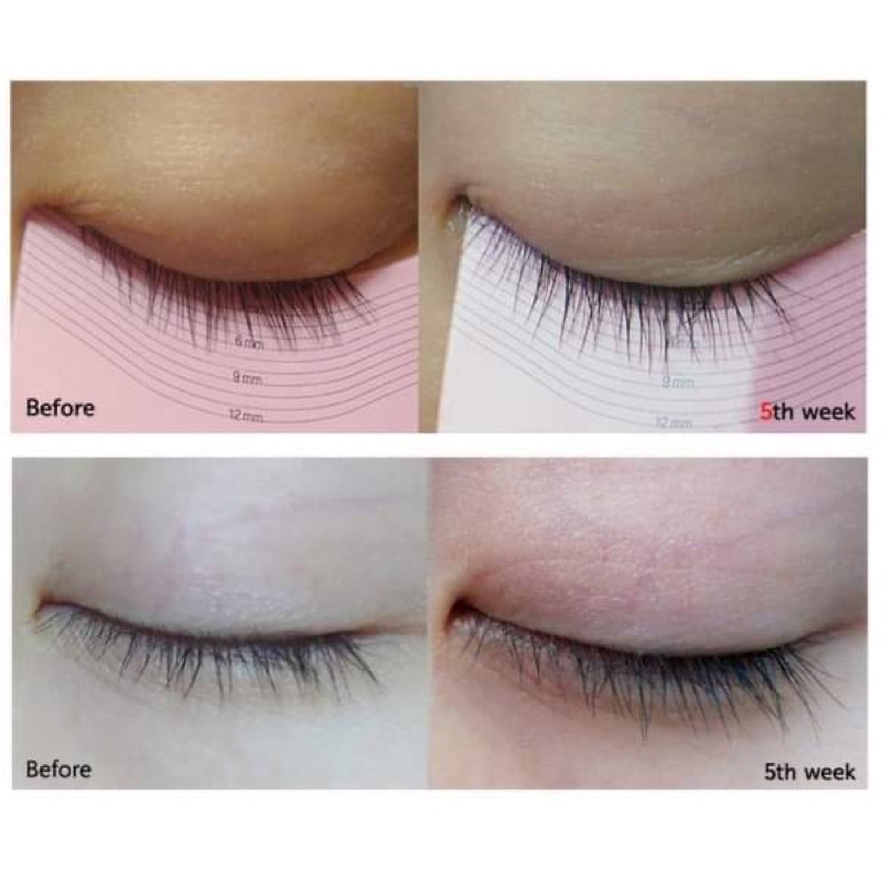 Serum dưỡng mi ETUDE HOUSE MY LASH SERUM