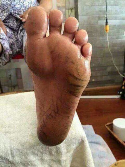 Kem trị nứt nẻ chân Nga BQ | BigBuy360 - bigbuy360.vn