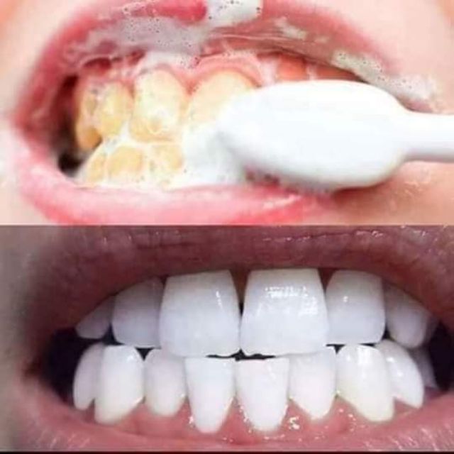 Bột trắng răng MINTS