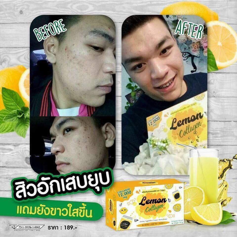 Trà chanh Lemon Collagen thailand