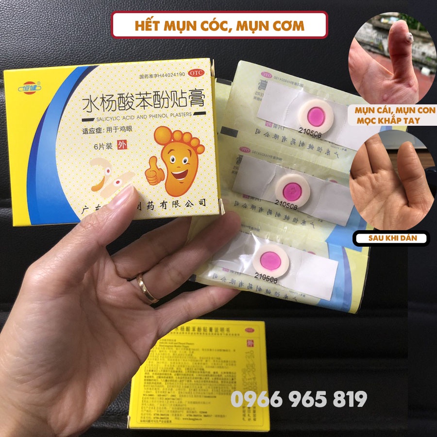 Miếng dán mụn cóc, mụn cơm hộp 6 miếng