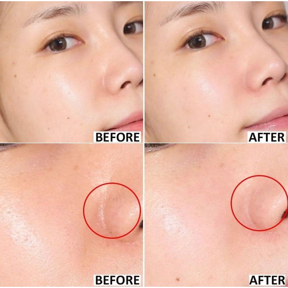 BHA Paula Choice 2%, Tẩy tế bào chết Paula's Choice Skin Perfecting 30ml. giảm mụn ẩn mụn đầu đen | BigBuy360 - bigbuy360.vn