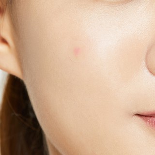 Miếng dán mụn COSRX Acne Pimple Master Pack (24 miếng)