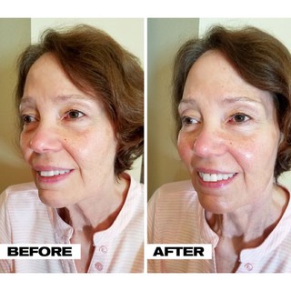Có bill 🇺🇸 THE ORDINARY Retinol 0.2% in Squalane
