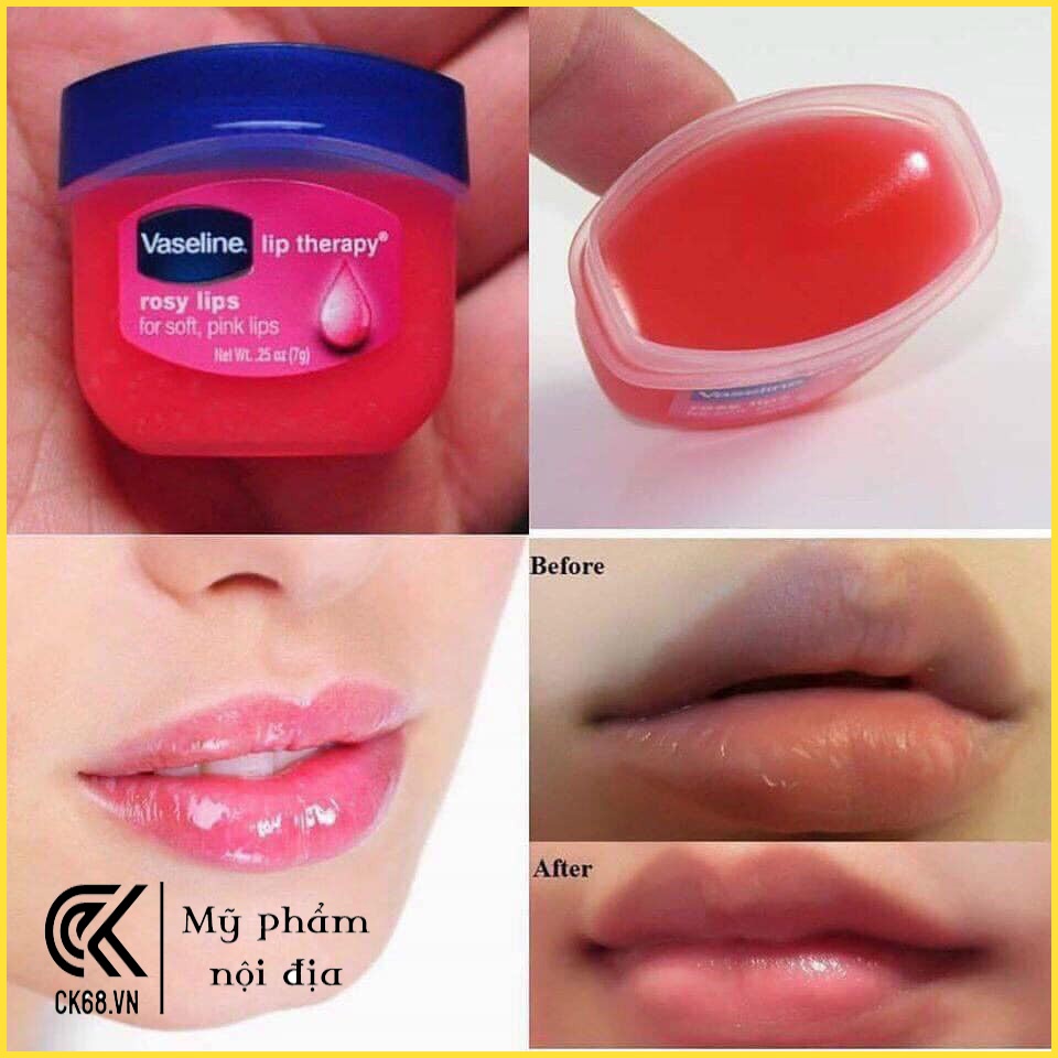 Son Dưỡng Môi Vaseline Mùi Hoa Hồng Lip Therapy Rosy Lips 7g