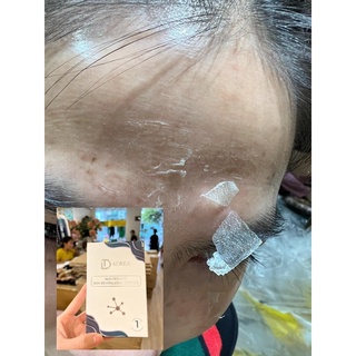 Peel Da Retinol Vi Tảo - trang nemo
