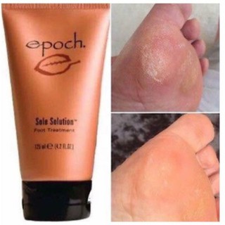KEM TRỊ NỨT GÓT CHÂN - EPOCH SOLE SOLUTION FOOT 125ML