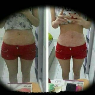 Sỉ 10 hộp ( 50 miếng ) dán tan mỡ