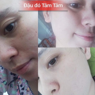 BỘT ĐẬU ĐỎ DƯỠNG DA MẶT TÂM TÂM (TÚI 300GR)
