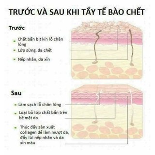 Tẩy tế bào chết Zoley