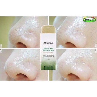 Thanh lăn mụn đầu đen Mamonde