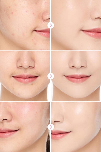 [Chính hãng] Phấn Nước Siêu Mỏng Nhẹ Cho Lớp Nền Tự Nhiên April Skin Magic Essence Shower Cushion SPF 50+ | BigBuy360 - bigbuy360.vn