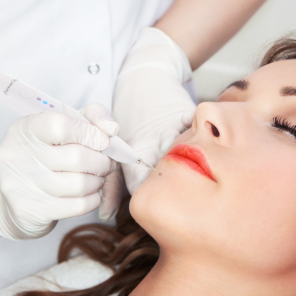 Foreverlily Bút Laser Xóa Tàn Nhang Đốm Đen Trên Da Mặt bút loại bỏ nốt ruồi