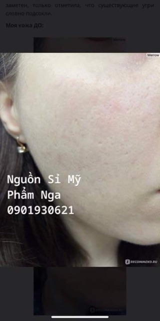 Serum TEANA SUPER PEPTIDES hổ trợ mụn 10 ống 2ml